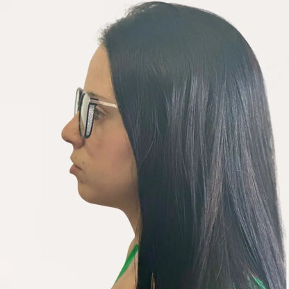 Offre exclusive 2 pour 1 – Lunettes Crystal Elite Vision